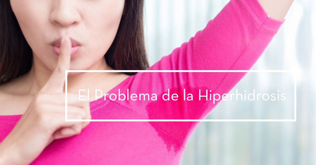 hipersudoracion