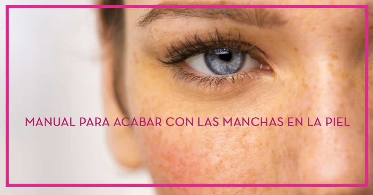 Acabar con las manchas faciales