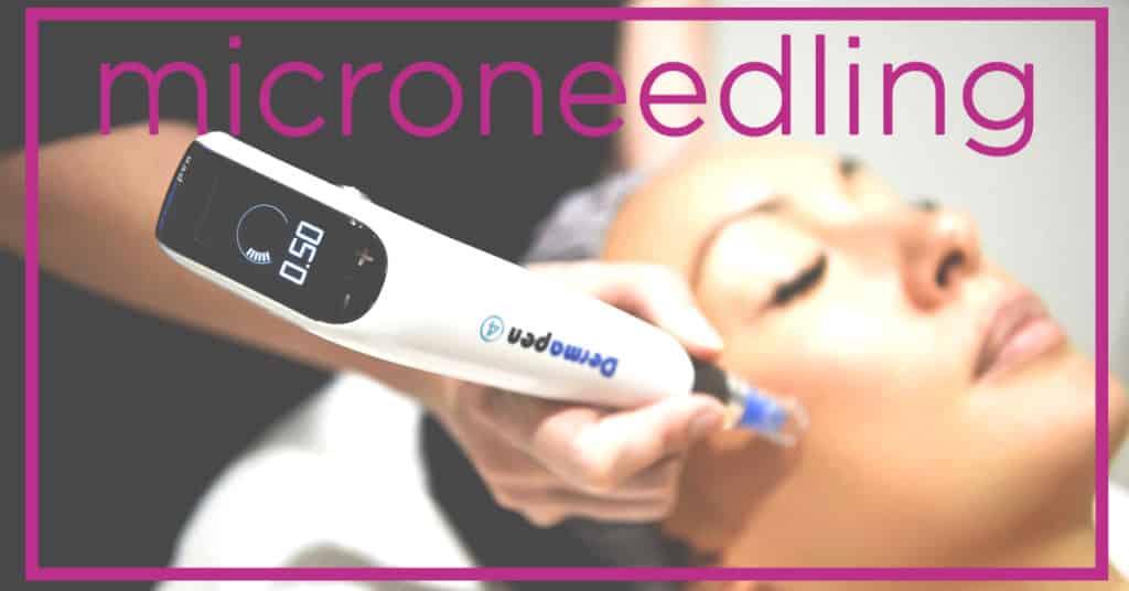 microneedling