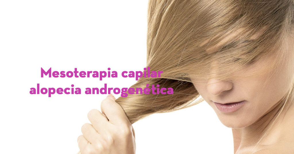 Mesoterapia capilar alopecia androgenética