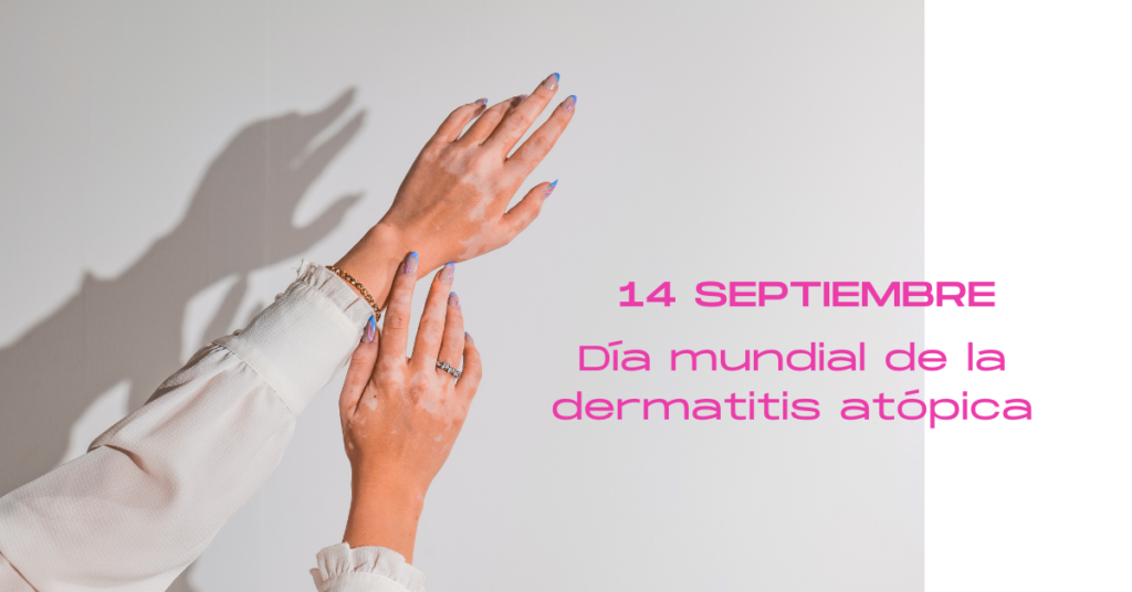 Día mundial de la dermatitis atópica