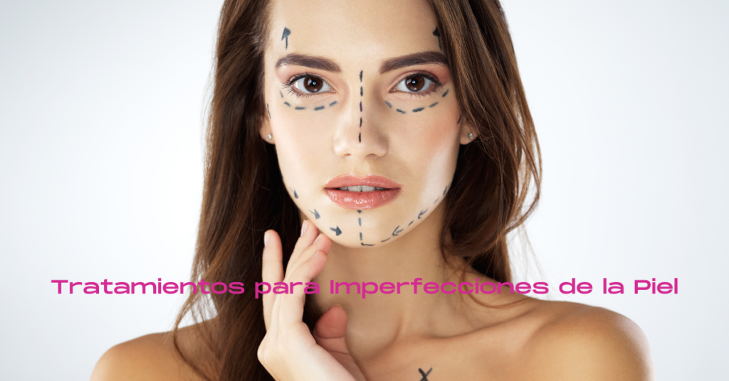 Tratamientos para Imperfecciones de la Piel